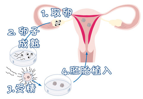 助孕儿子包成功